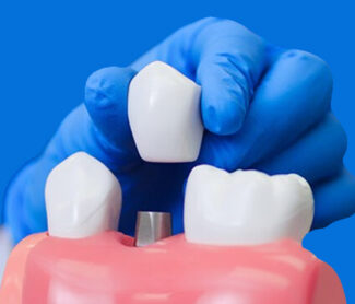 Choosing the Best Dentist for Your Dental Implant Procedure