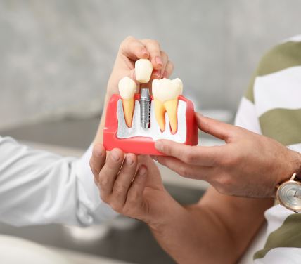 Dental Implants