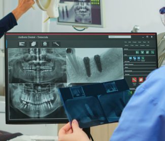 Why Bone Grafting Is Worth It for Smiles